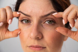 Close up of a woman holding her eyes open, possibly in need of eyelid shaping surgery or blepharoplasty