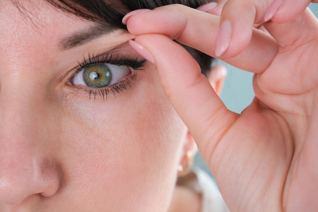 Close-up of a woman pinching the excess skin on her eyelid, in need of a blepharoplasty.