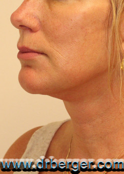 After Image